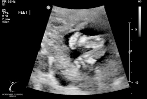 ultrasound 2014-12-10 02.jpg